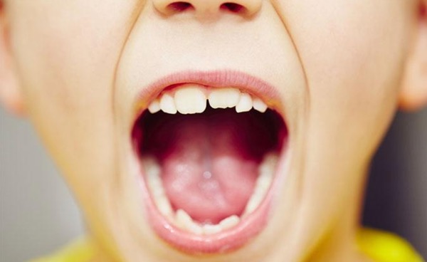 Mơ thấy răng đánh con gì? - Ảnh 2